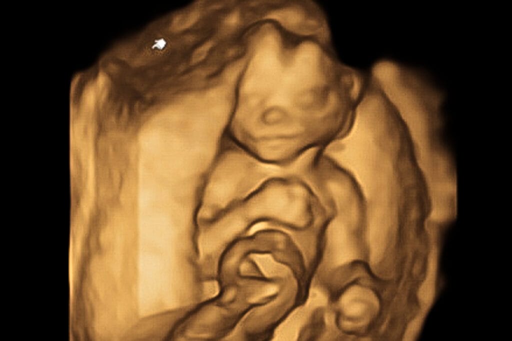 We had a 4D scan at 16 weeks pregnant